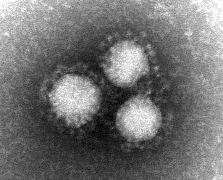 MERS-neg.jpg